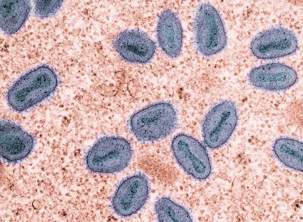 Mpox Virus Colorized transmission electron micrograph of mpox virus particles (purple and teal) found within an infected cell (brown), cultured in the laboratory. Image captured at the NIAID Integrated Research Facility (IRF) in Fort Detrick, Maryland. Credit: NIAID https://www.flickr.com/photos/niaid/52989161754/